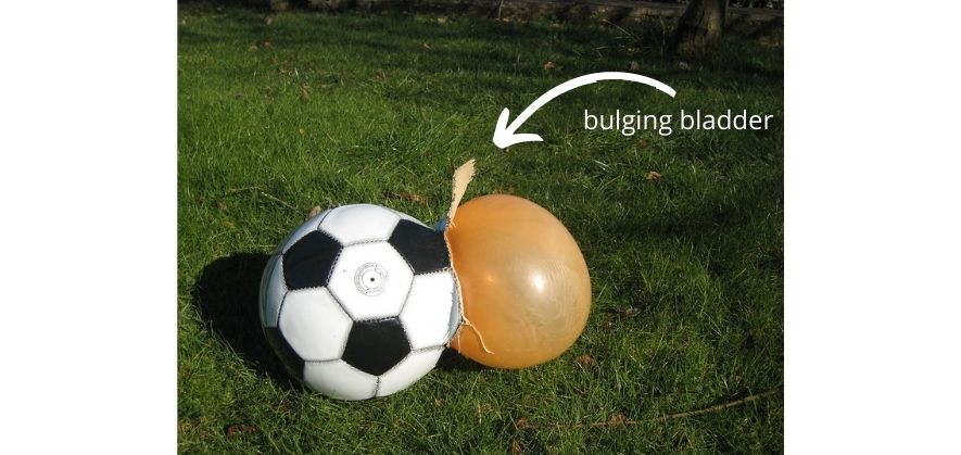 dangers of leaving your soccer ball in the car - bulging bladder